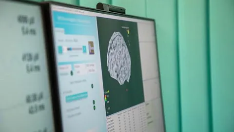 Разработка ученых из Калининграда поможет выявить болезни головного мозга