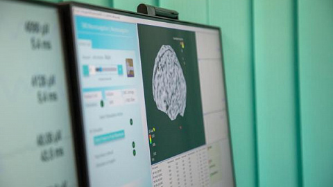 Новая технология «мысленного тренажера» поможет в реабилитации пациентов после инсульта